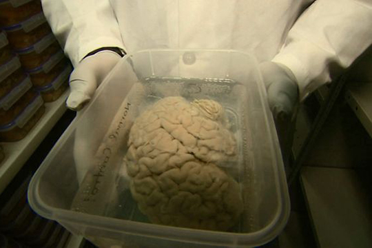 Գիտնականները մարդկանց կոչ են արել իրենց ուղեղը զոհաբերել գիտությանը