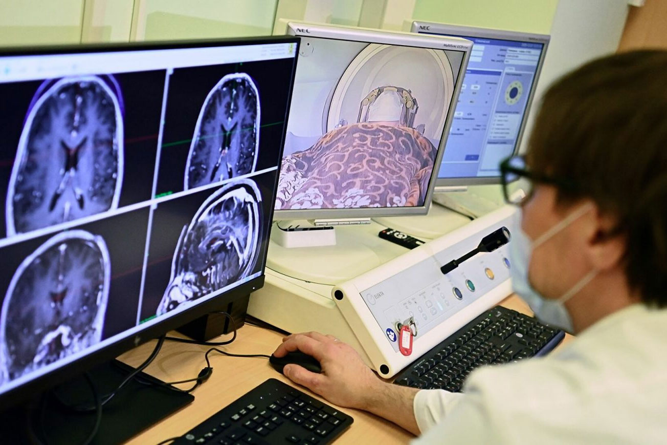 Գիտնականները մշակել են ուղեղի ծերացումը գնահատող մեթոդ